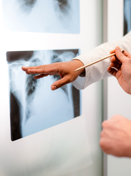 X Ray