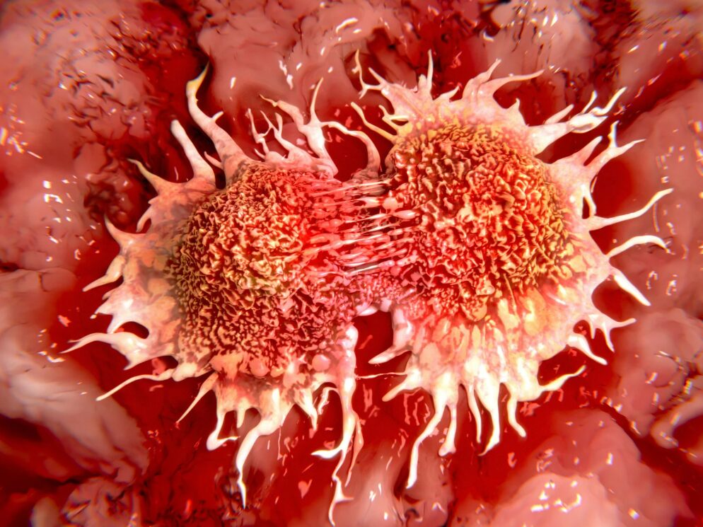 Cancer Cell